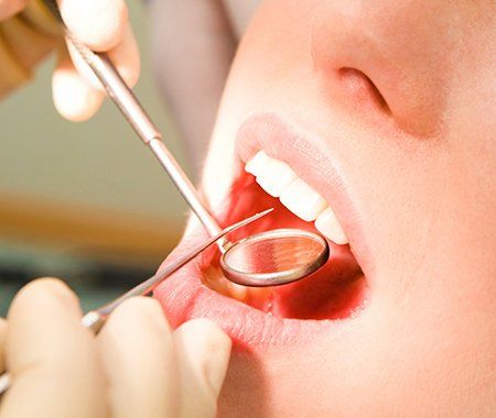 Clínica Dental Doctora Blanca Rueda odontólogo revisando dientes de una paciente